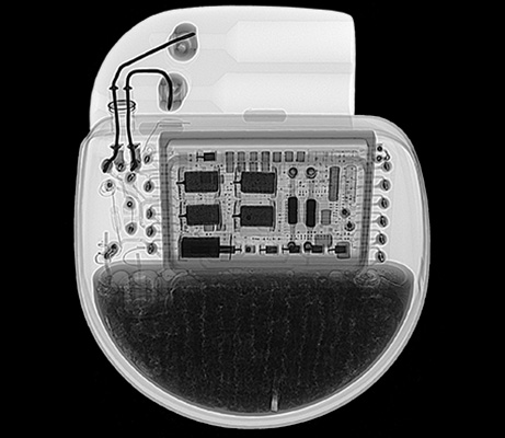 X-ray inspection of a pacemaker