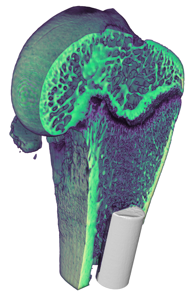 X-ray inspection of a femur implant