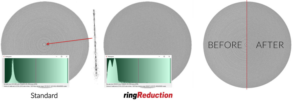 ringReduction Advanced X-Ray Scanning