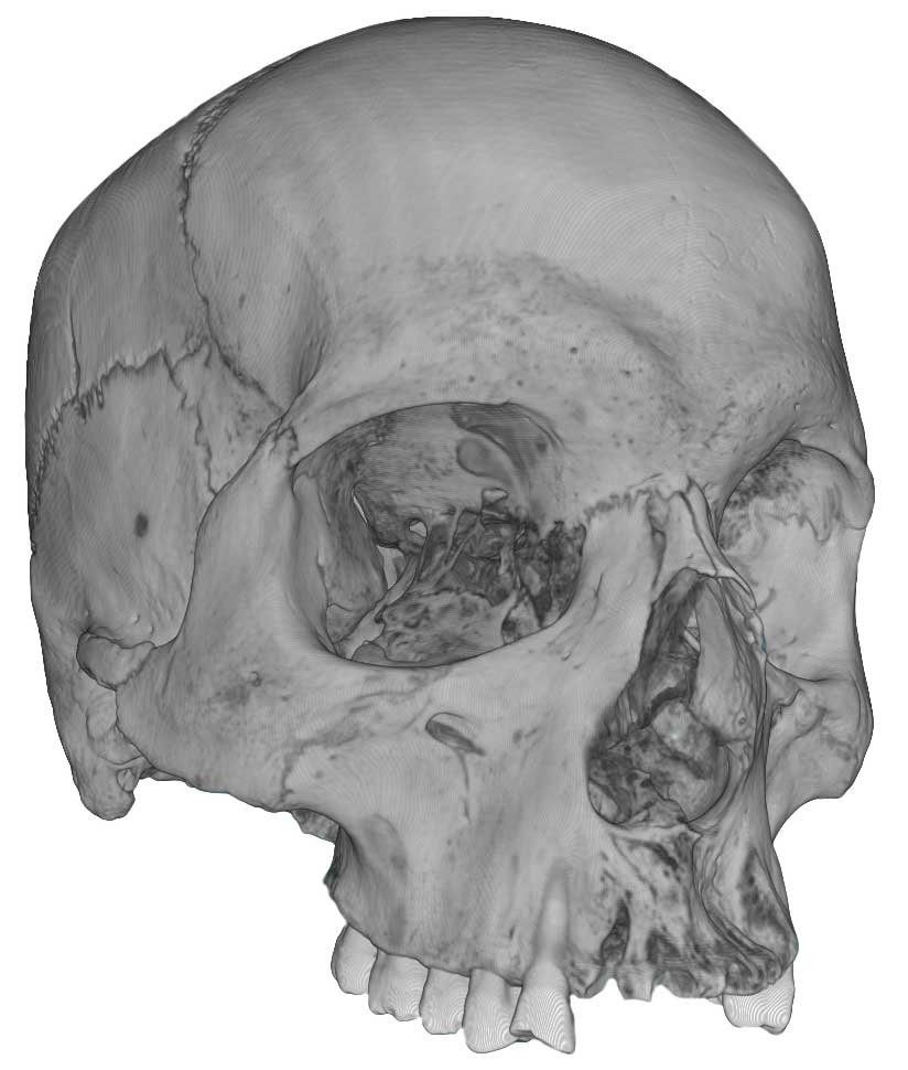 X-ray scan of a human skull